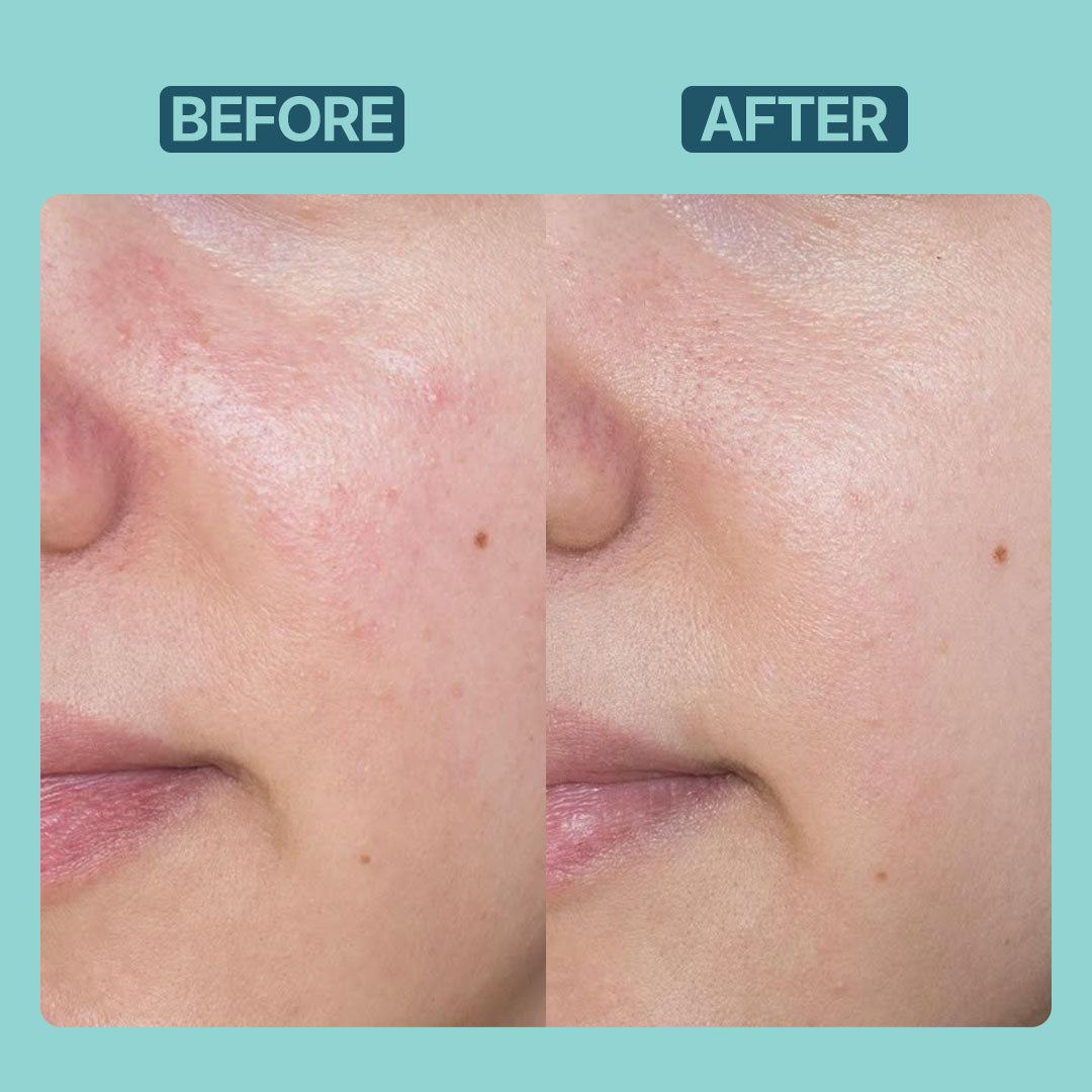Brightening Moisturizer | Non Greasy, Light Weight