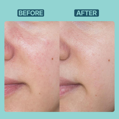 Brightening Moisturizer | Non Greasy, Light Weight