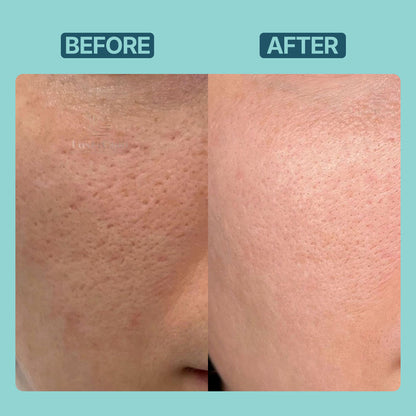 Hyaluronic Acid Serum | Sodium Hyaluronate 2%