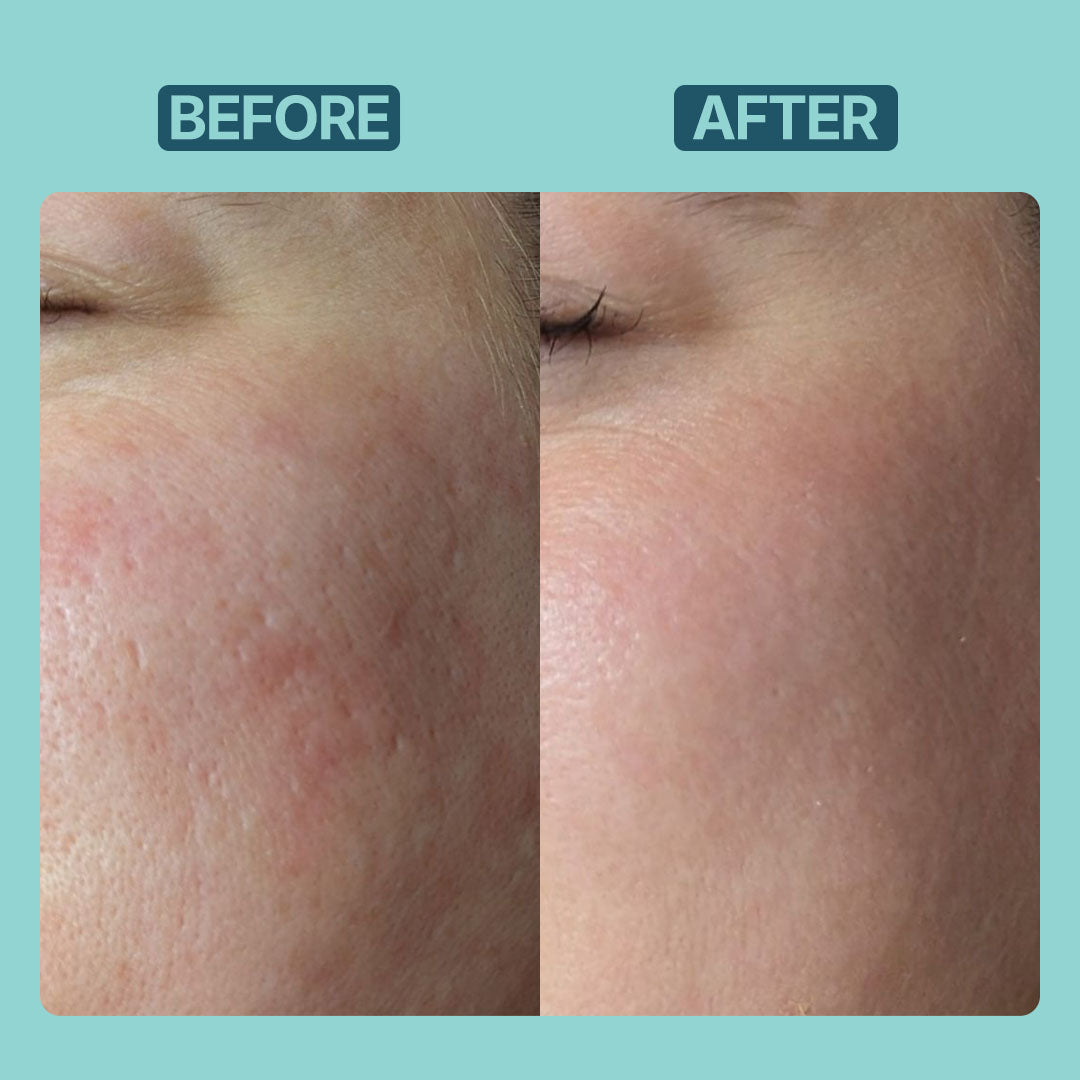 L Glutathione Brightening Serum