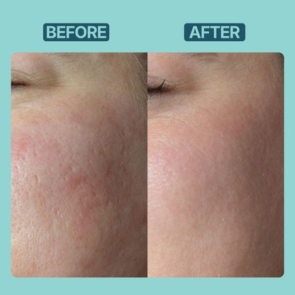 L Glutathione Brightening Serum