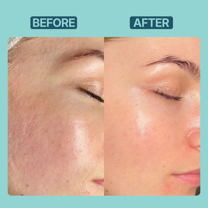Niacinamide Serum 10% ! Advance Formula