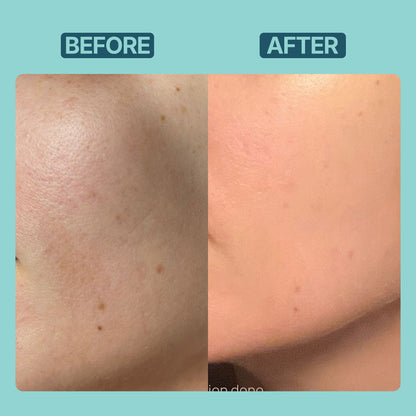 Pigmentation Control Serum