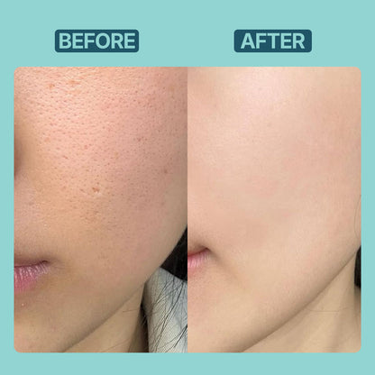 Retinol Serum - Retinol 1% + Vitamin E With Avocada Oil
