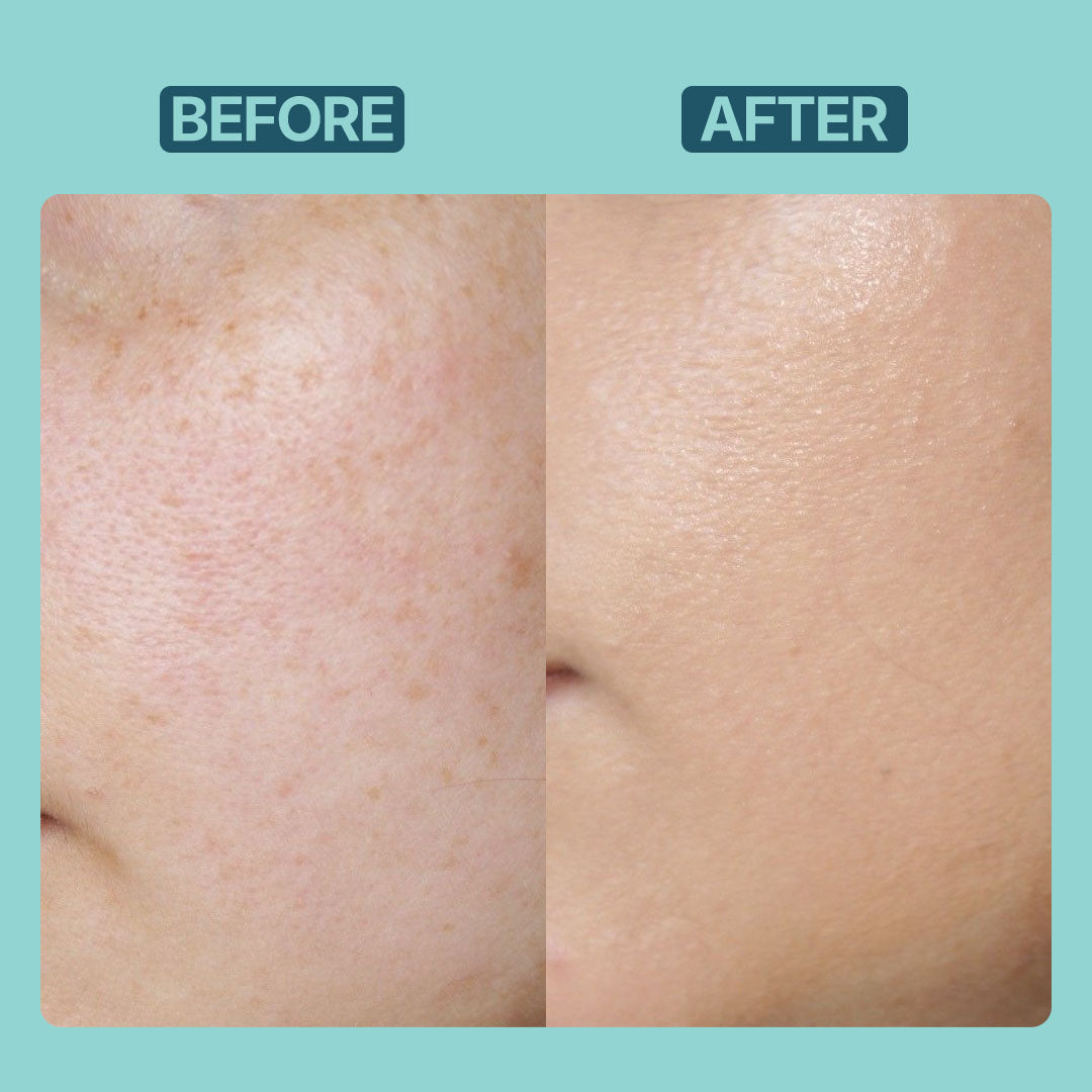 Skin Whitening Cream