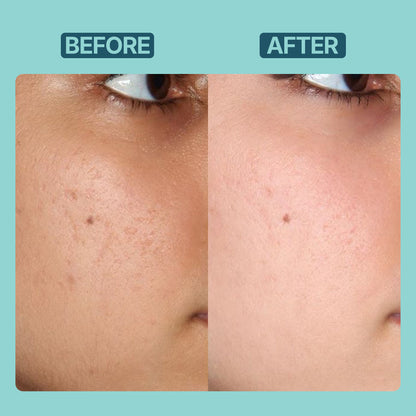 Vitamin C serum- 10% Ethyl Ascorbic Acid